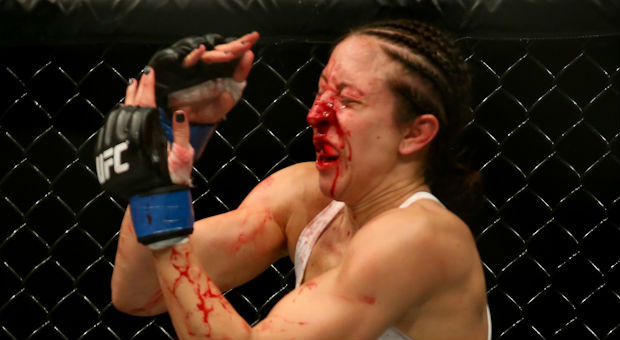 Najbrutalniej złamane nosy w historii MMA (video)