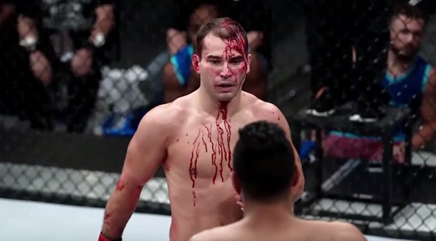Artem Lobov wraca w boju z Alexem Whitem na UFC 196