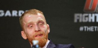 Z powodu bardzo rzadkiej choroby, Paddy Holohan przechodzi na emeryturę