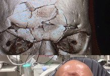 Evangelista „Cyborg” Santos w grudniu zamierza ponownie wejść do klatki