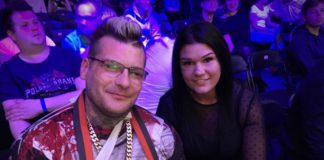 „Popek” kontuzjowany?