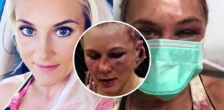 To cię śmieszy? Zdemolowana Yana Kunitskaya w szpitalu po walce na UFC