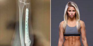 Paige VanZant znów kontuzjowana, złamana ręka wymaga operacji Paige VanZant znów kontuzjowana, złamana ręka wymaga operacji
