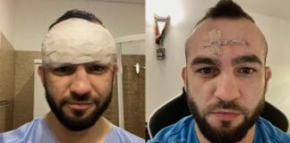 „Czaszka pękła!” – Krakowiak ujawnił jak poważnego urazu doznał w debiucie dla KSW marcin krakowiak