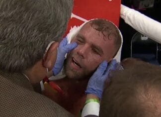 Billy Joe Saunders doznał poważnych złamań w okolicach oczodołu