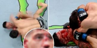Joel Alvarez opublikował zdjęcia potwornego rozcięcia z sobotniej walki z Armanem Tsarukyanem