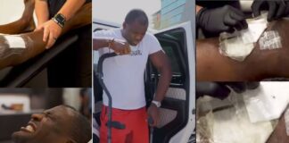 „Krok po kroku” – Ngannou pokazał kolano po operacji i początek rehabilitacji ngannou