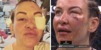Kobiety płacą fortuny za takie usta – Miesha Tate po bolesnej porażce z Lauren Murphy