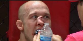 Makabryczne złamanie nosa po brutalnym kolanie na gali Urijaha Fabera (WIDEO)