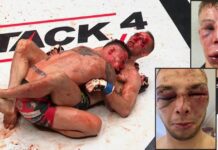 Krystian Blezień i Mateusz Makarowski po morderczej walce na MMA Attack 4 – zdjęcie dnia