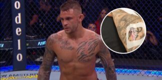 „Robi się poważnie” – Dustin Poirier wylądował w szpitalu