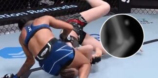 Okropne przemieszczenie w łokciu po walce na UFC on ESPN 49 (WIDEO)
