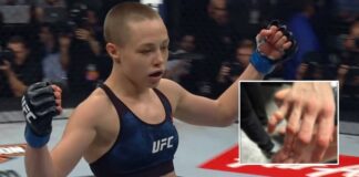 Namajunas pokazała okropne złamanie palca, którego doznała w walce z Fiorot