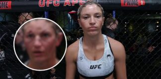 Nie dla wrażliwych! Potworne rozcięcia na twarzy zawodniczki po gali UFC on ESPN+ 88