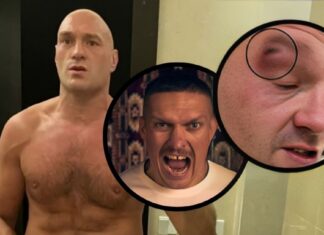Tyson Fury wypada z walki z Oleksandrem Usykiem. Pokazał fatalne rozcięcie, fragment sparingu (WIDEO)
