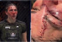 Podczas UFC 306, Irene Aldana doznała jednego z najgorszych rozcięć w historii MMA