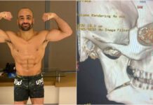 Eddie Alvarez złamał szczękę w walce na gołe pięści z Jeremym Stephensem
