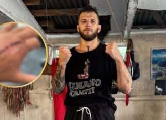 Dan Hooker pokazuje kontuzjowaną rękę po operacji (WIDEO)