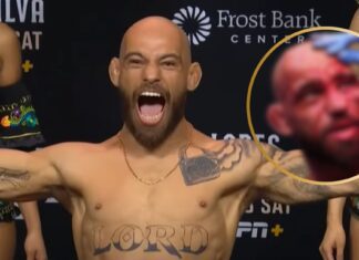 Zmasakrowana twarz Jeana Silvy po walce wieczoru UFC Noche