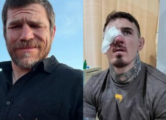 „Wówczas wszyscy szybko przestaliby to robić”. Jim Miller o trafianiu palcami w oczy