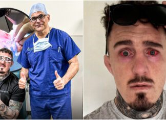 Mistrz UFC, Tom Aspinall pokazuje swój stan po operacji oczu