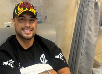 Nowy mistrz UFC, Carlos Ulberg przeszedł operację kolana