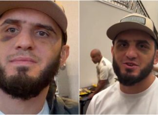 Obrażenia mimo wygranej. Twarz Islama Makhacheva na kilka dni po walce z Ianem Machado Garrym na UFC 330